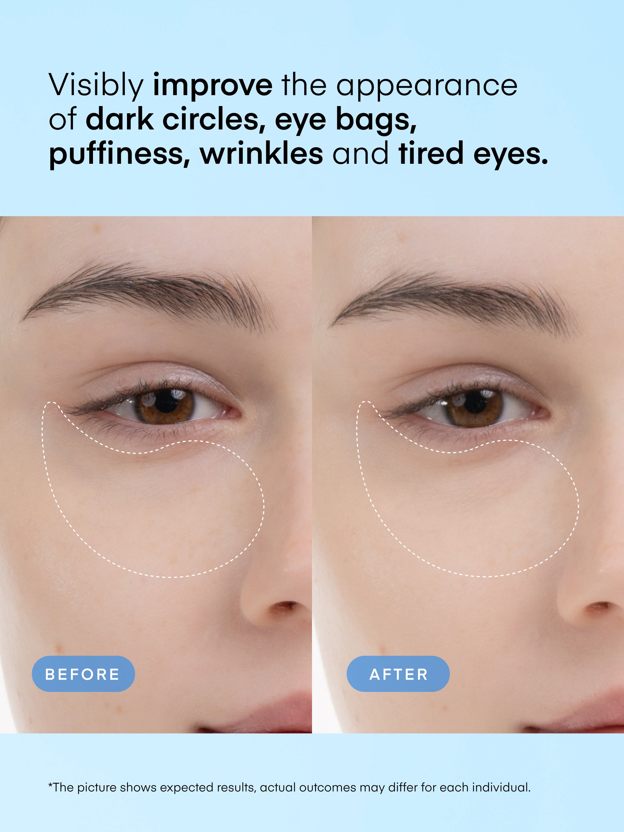 Caffeine & Hyaluronic Acid Eye Gel Patch