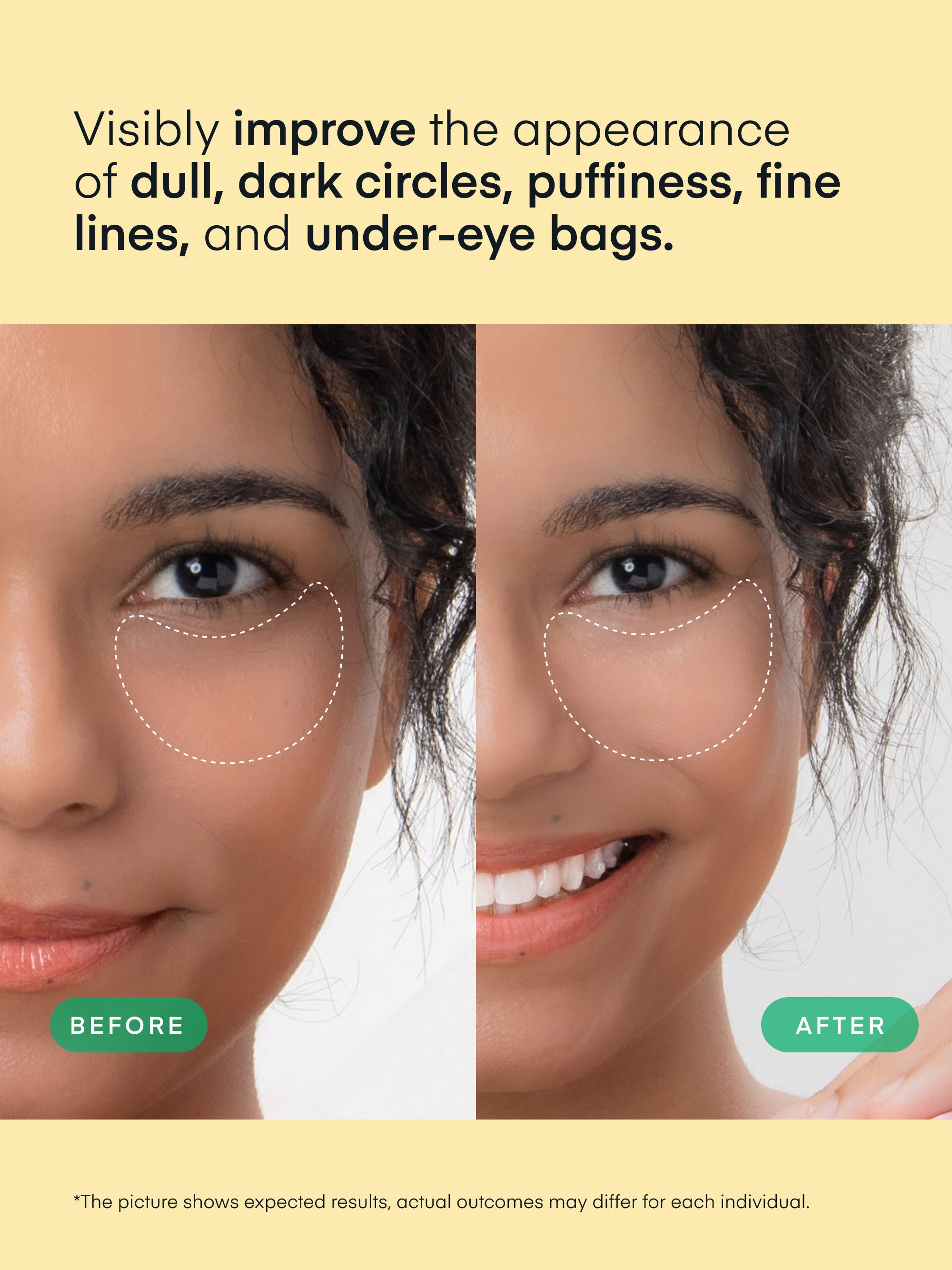 Vitamin C Niacinamide Eye Gel Patch