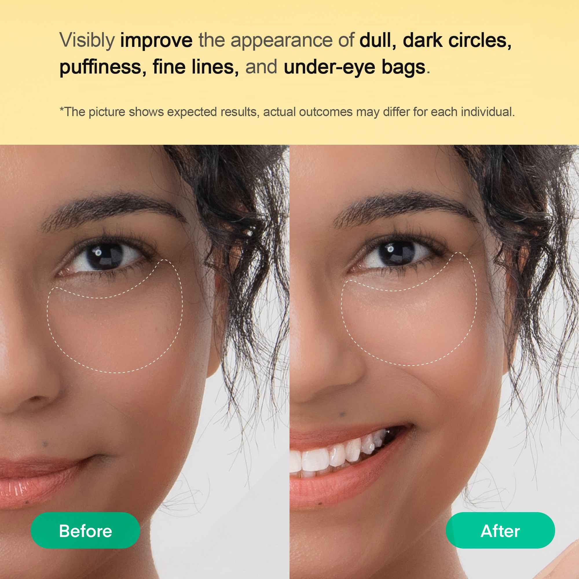 Vitamin C Niacinamide Eye Gel Patch