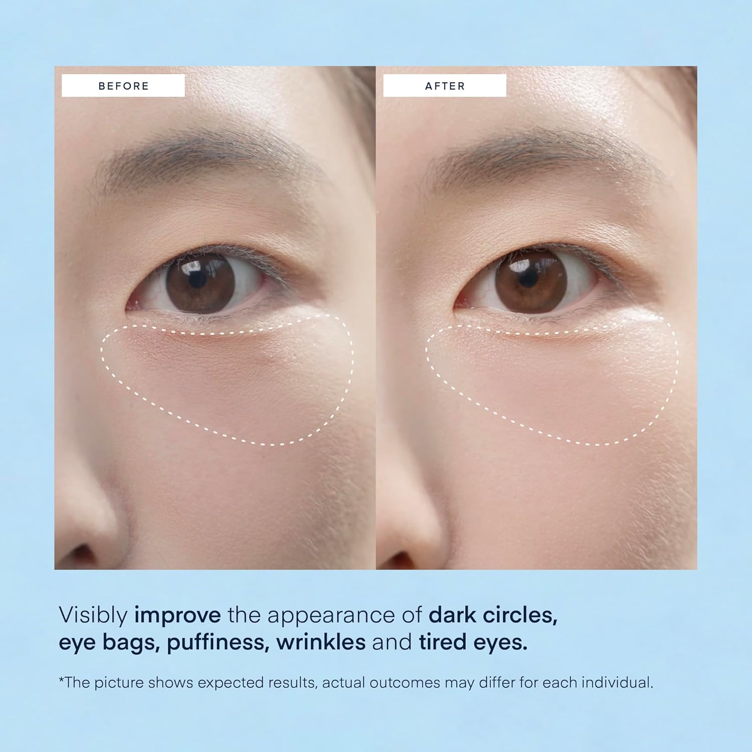 Caffeine &amp; Hyaluronic Acid Eye Gel Patch