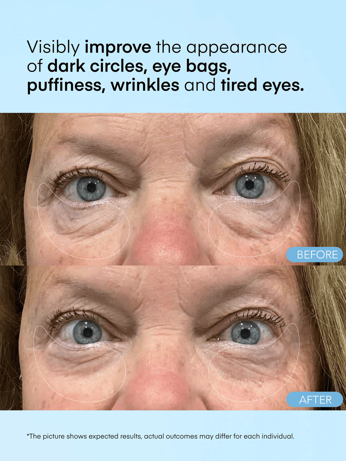 Caffeine &amp; Hyaluronic Acid Eye Gel Patch