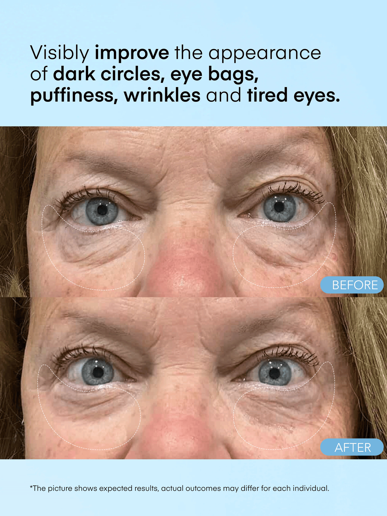 Caffeine &amp; Hyaluronic Acid Eye Gel Patch