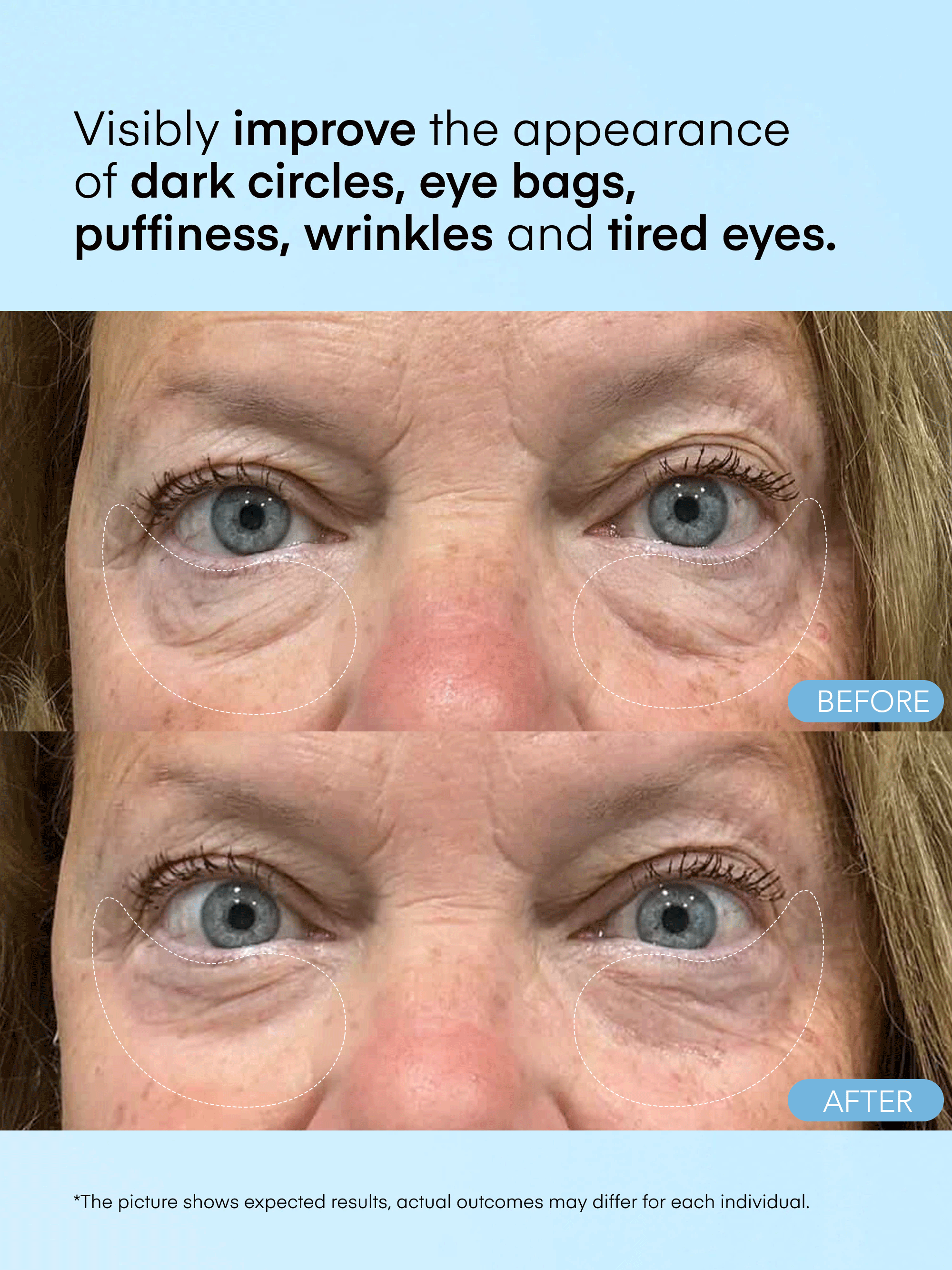 Caffeine &amp; Hyaluronic Acid Eye Gel Patch