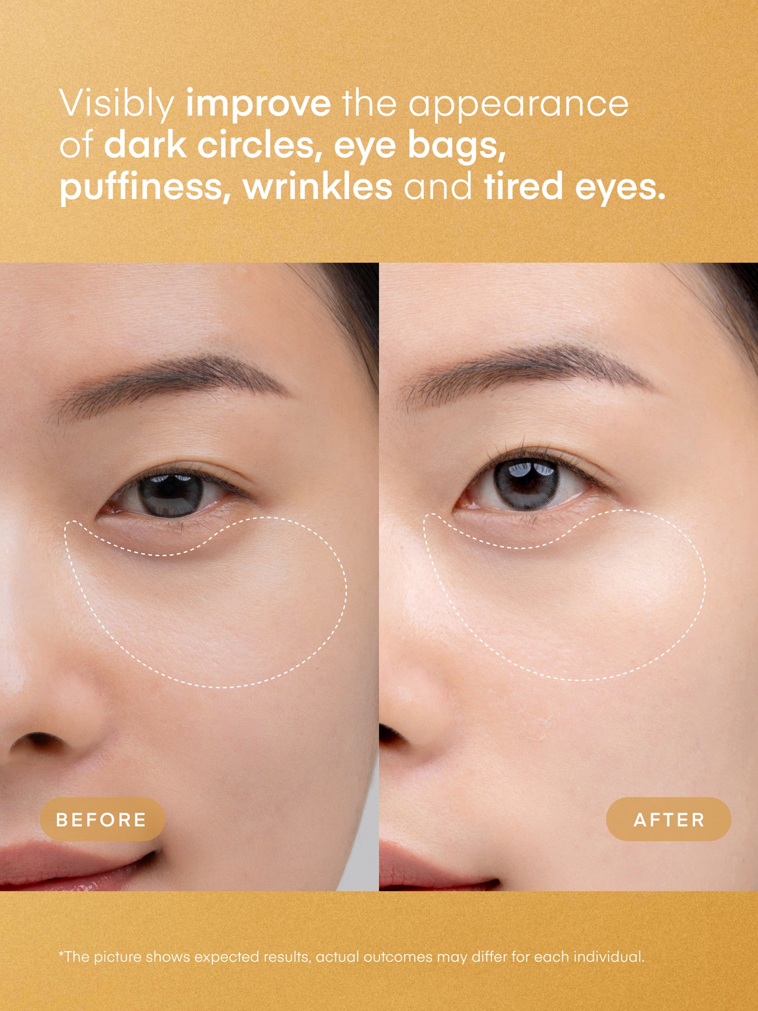 Parche de gel oftálmico con niacinamida y vitamina C