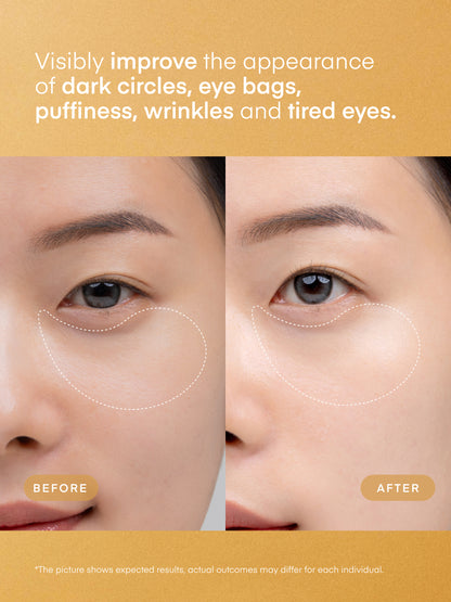 Parche de gel oftálmico con niacinamida y vitamina C