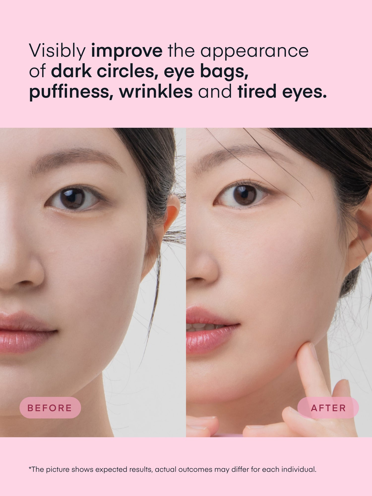 Parche de gel de colágeno multipéptido para ojos